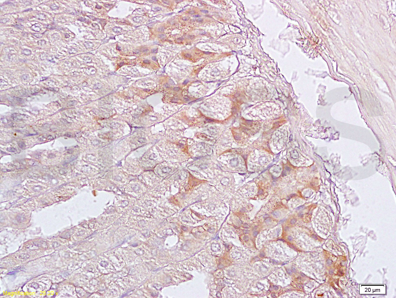 SGCB Rabbit pAb(bs-1127R)-50ul