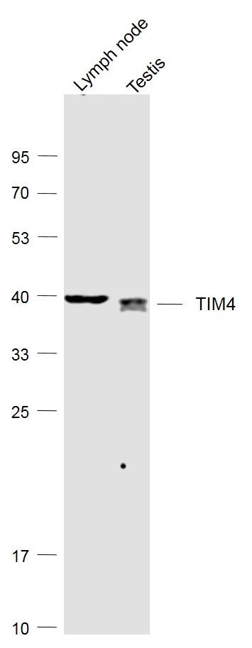 TIM4 Rabbit pAb(bs-6197R)-50ul