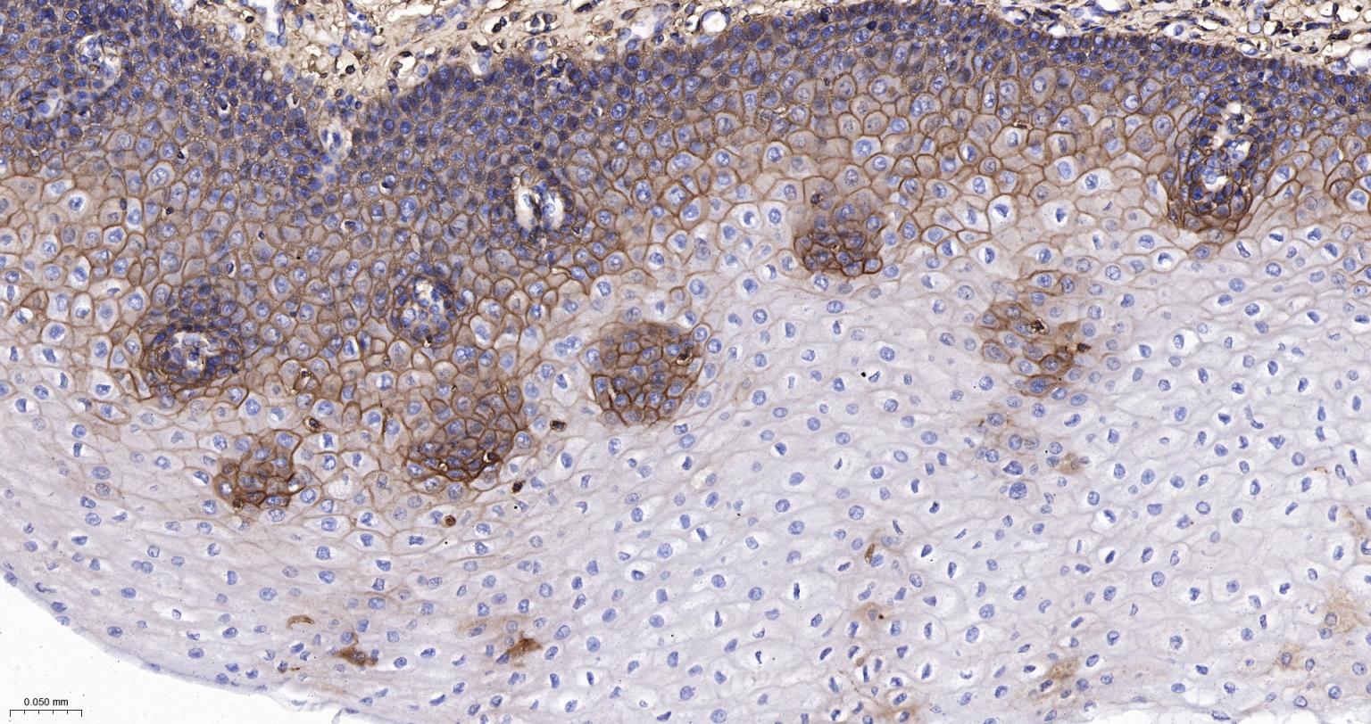 CD44 Recombinant Rabbit mAb(bs