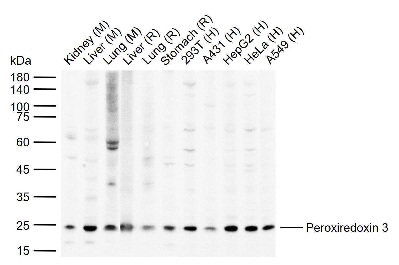 Peroxiredoxin 3 Rabbit pAb(bs-