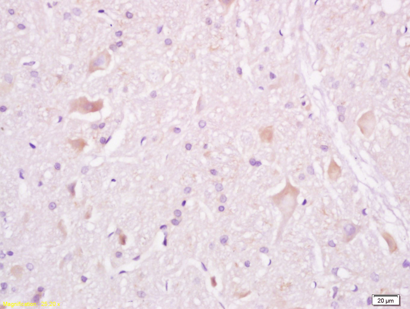 Tuberin Rabbit pAb(bs-3586R)-5