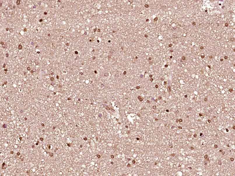 RARB Rabbit pAb(bs-0516R)-50ul