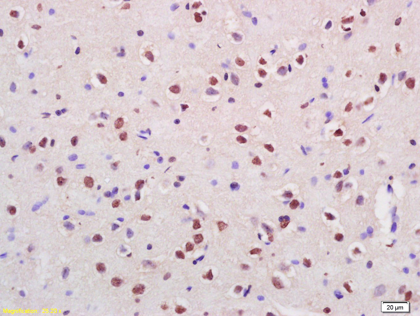 Cux2 Rabbit pAb(bs-11832R)-50u