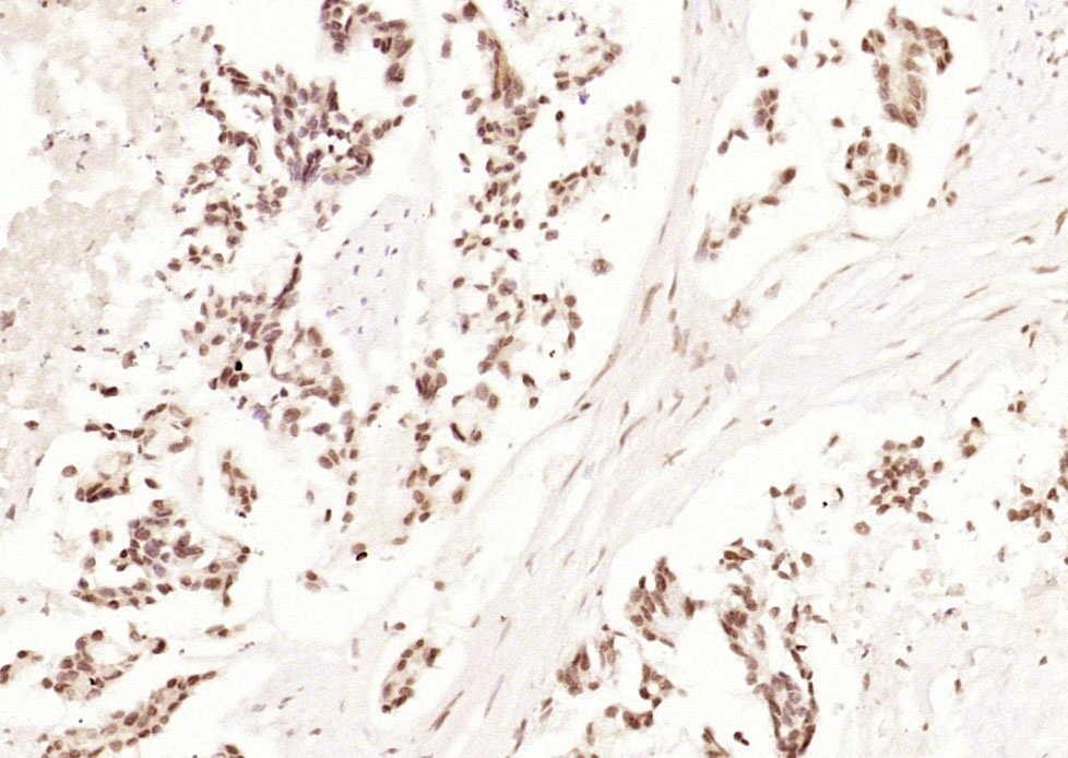 JNK1 + JNK3 Rabbit pAb(bs-0501