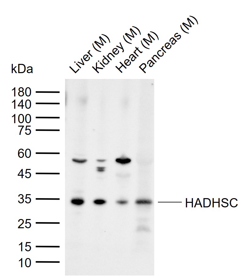 HADHSC Rabbit pAb(bs-10020R)-5
