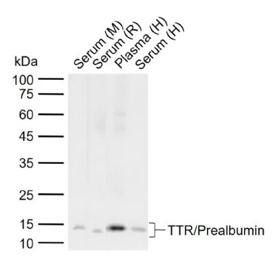 TTR/TTR/Prealbumin Rabbit pAb(