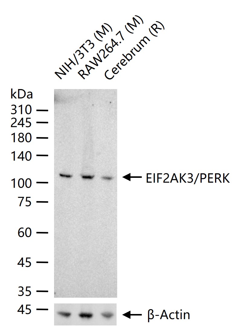 EIF2AK3/PERK Mouse mAb(bsm-513