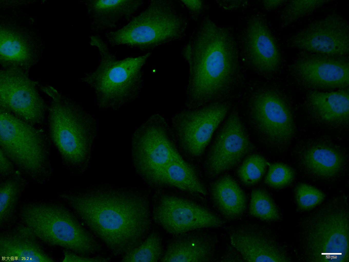 SQSTM1/P62 Rabbit pAb(bs-2951R
