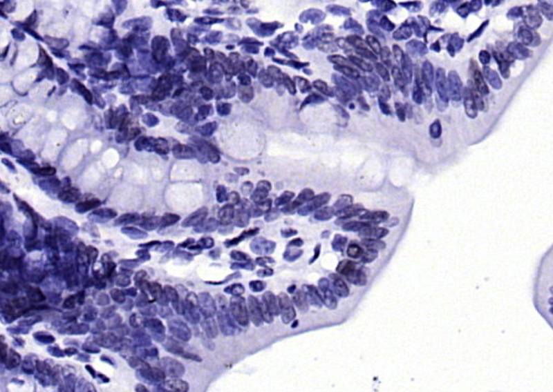 phospho-H2AX (Tyr143) Rabbit p