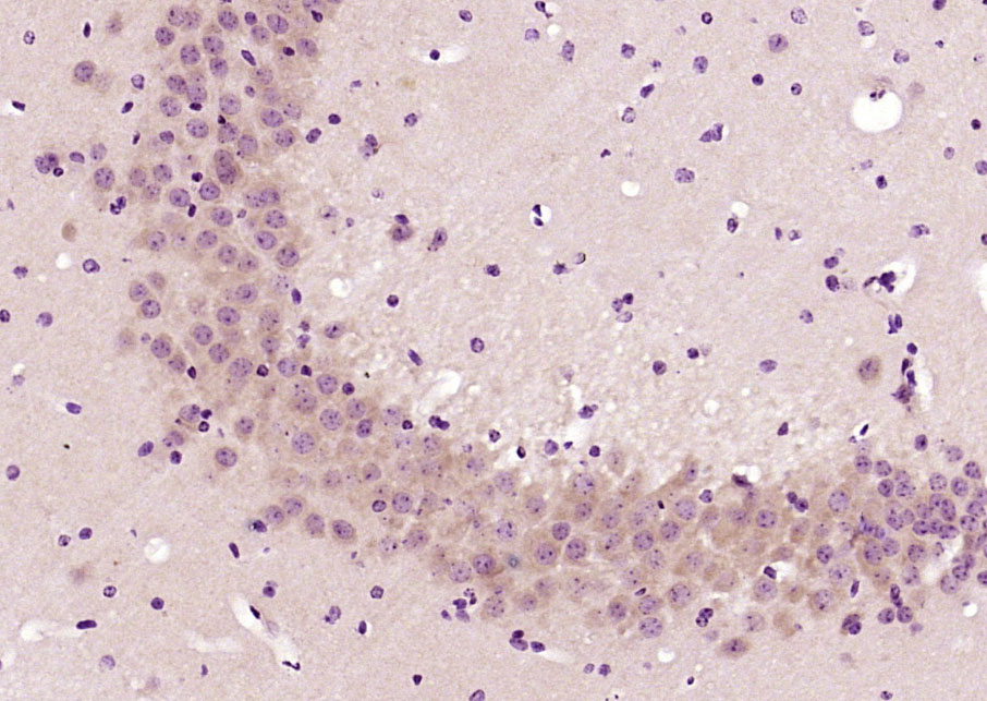 Tropomodulin 2 Rabbit pAb(bs-1