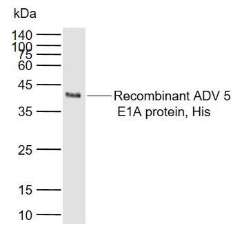 Adenovirus 5 E1A Rabbit pAb(bs