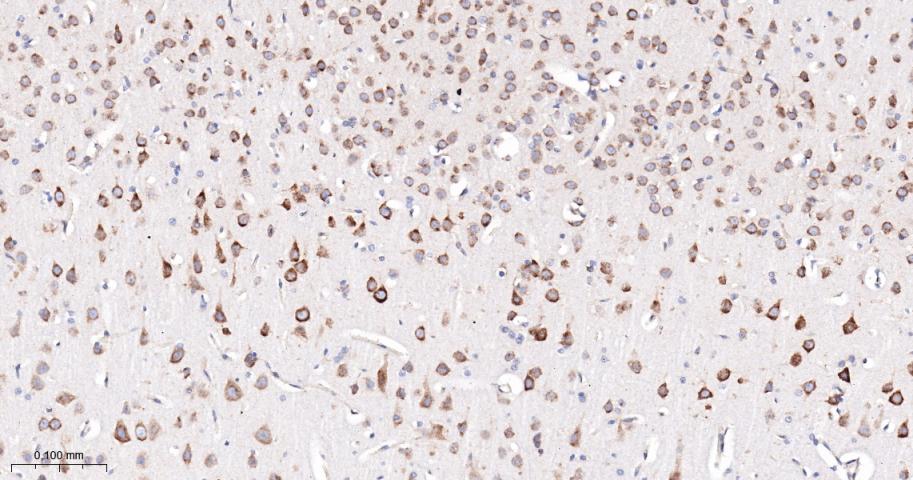 phospho-FoxO3a (Ser253) Recomb