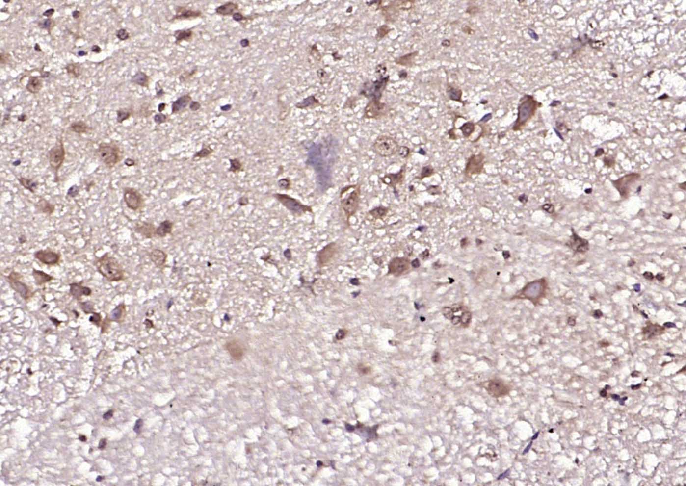 MLC1 Rabbit pAb(bs-7115R)-50ul