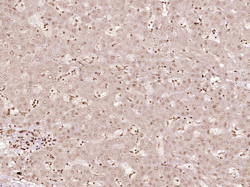phospho-CDK6 (Tyr13) Rabbit pA