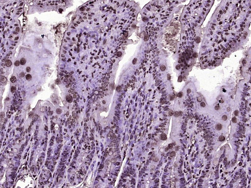 PLK2 Rabbit pAb(bs-12730R)-50u