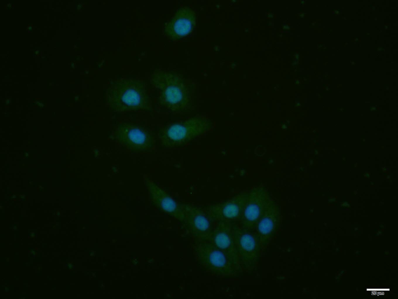 SPDEF Rabbit pAb(bs-1866R)-50u