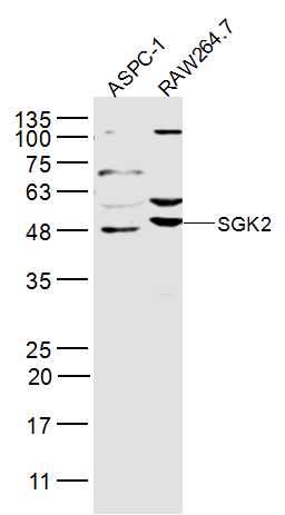 SGK2 Rabbit pAb(bs-17316R)-50u