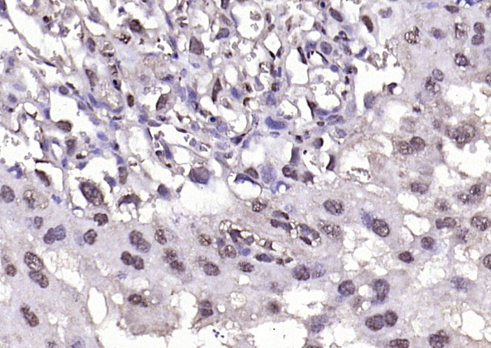 phospho-BRAF (Thr401) Rabbit p