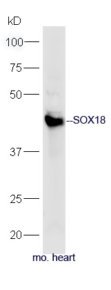 SOX18 Rabbit pAb(bs-17135R)-50