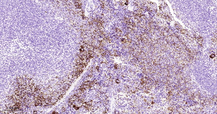 GP1BA Recombinant Rabbit mAb(b