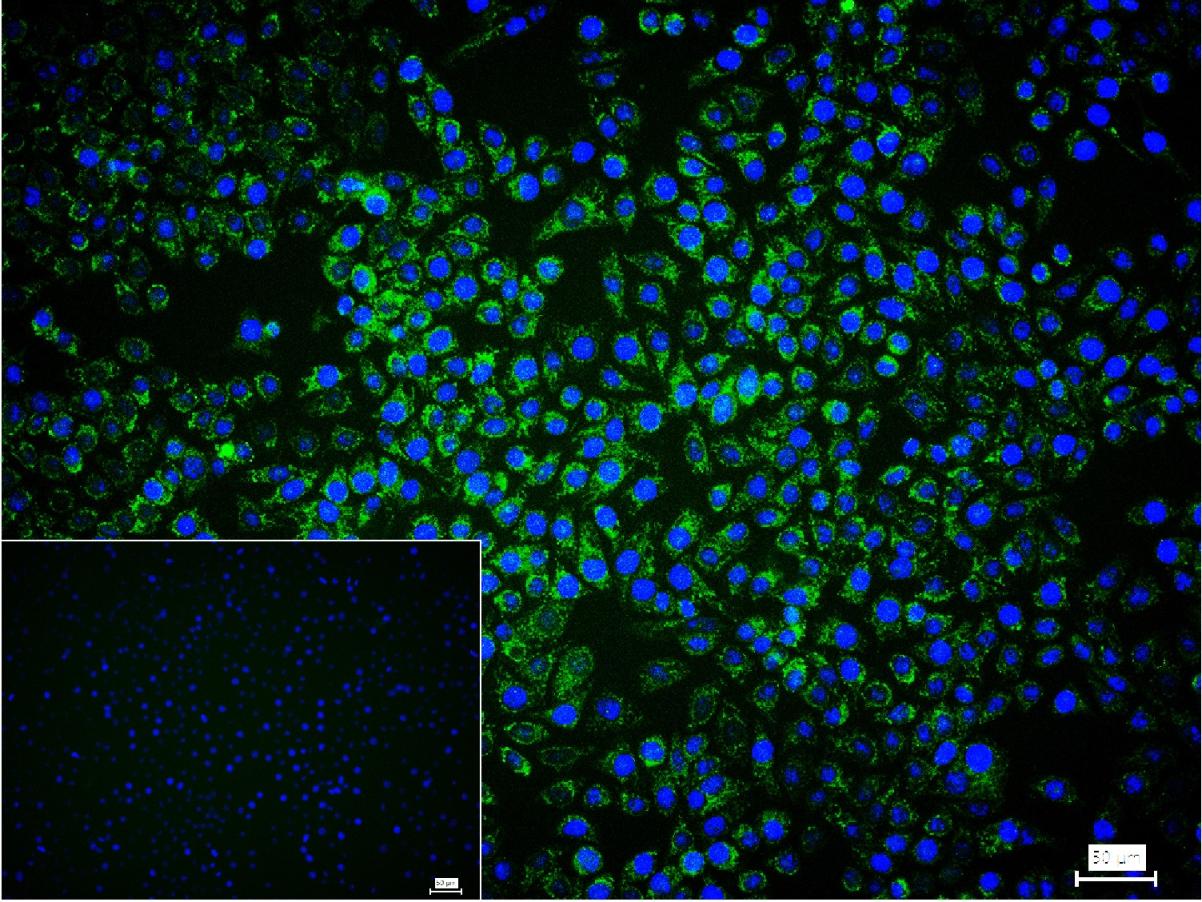 SDHB Recombinant Rabbit mAb(bs
