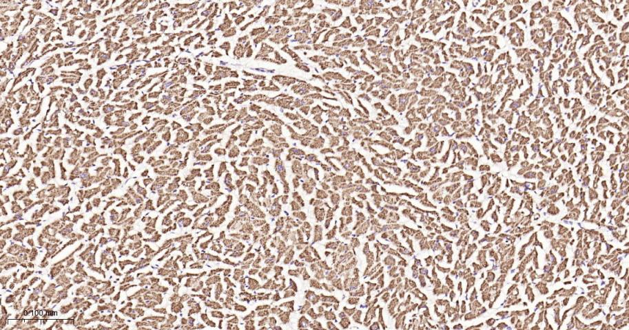 SDHB Recombinant Rabbit mAb(bs