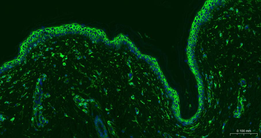CD44 Recombinant Rabbit mAb(bs