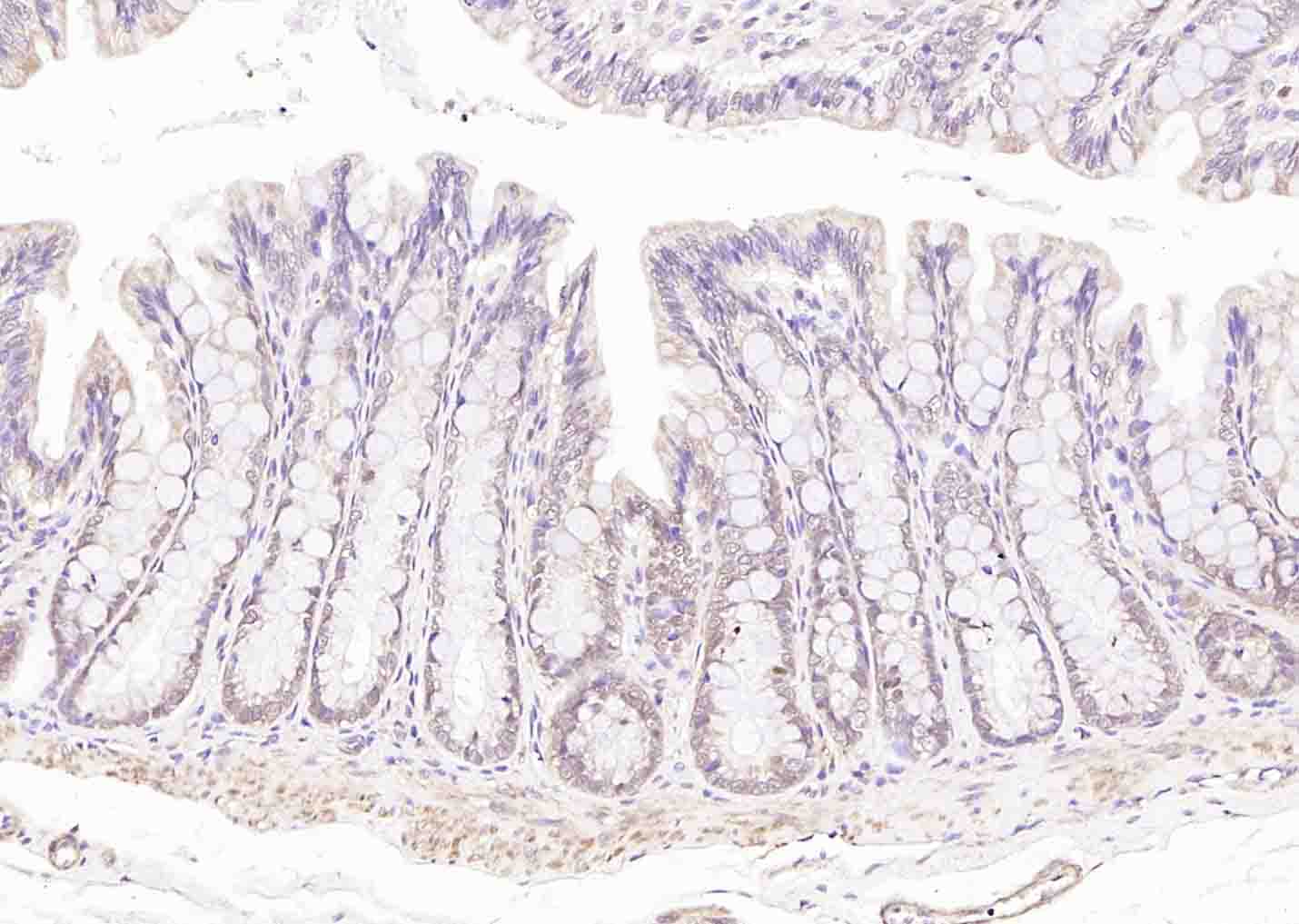 LKB1 Rabbit pAb(bs-3948R)-50ul