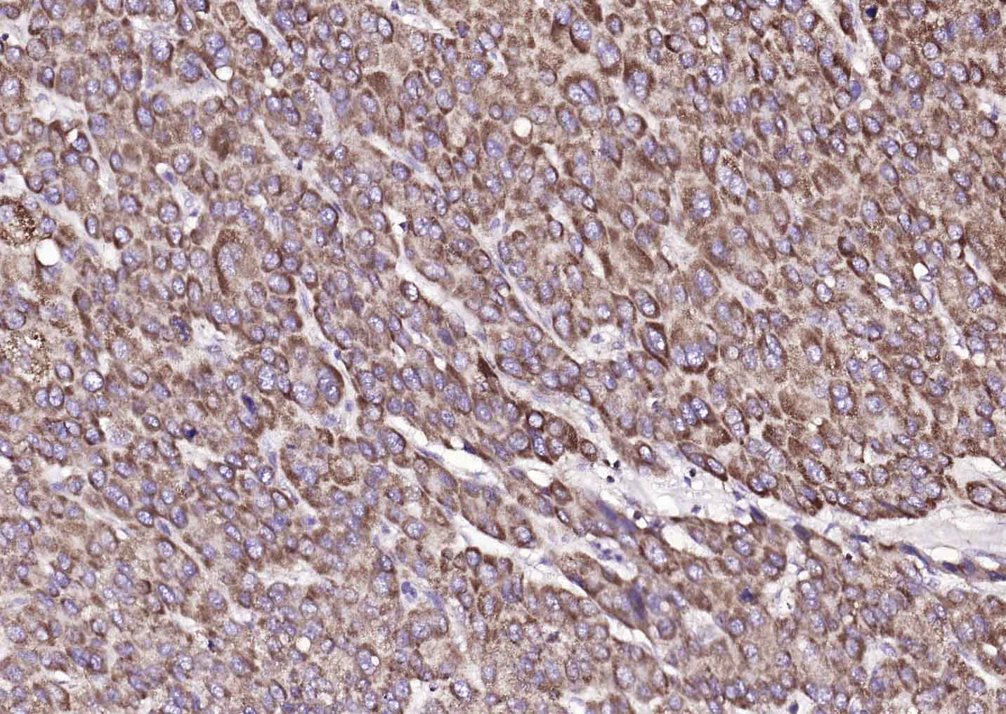 ATP7B Rabbit pAb(bs-1718R)-50u