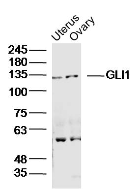 GLI1 Rabbit pAb(bs-1206R)-50ul