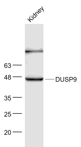 DUSP9 Rabbit pAb(bs-14461R)-50