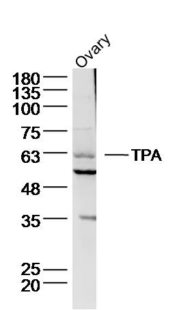 TPA Rabbit pAb(bs-1545R)-50ul/