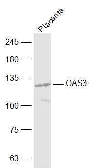 OAS3 Rabbit pAb(bs-7344R)-50ul