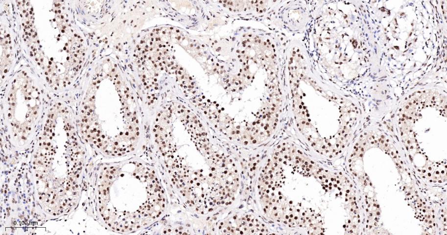 KDM4B Recombinant Rabbit mAb(b