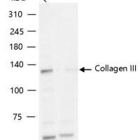 Collagen III Knockout Hela Cell Line (Pool)