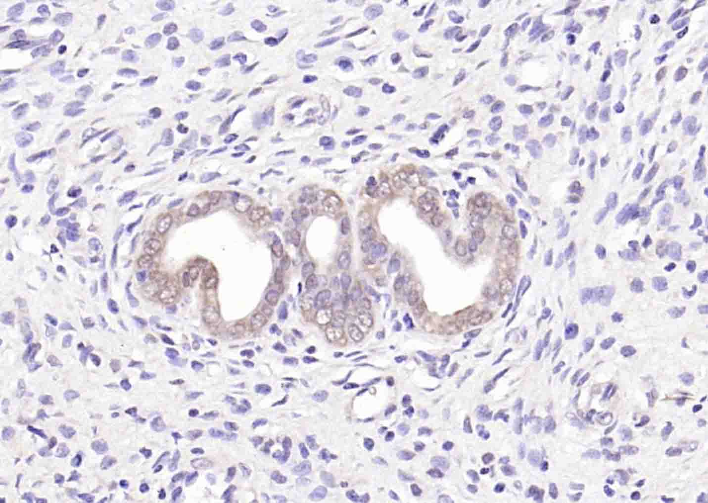 LKB1 Rabbit pAb(bs-3948R)-50ul