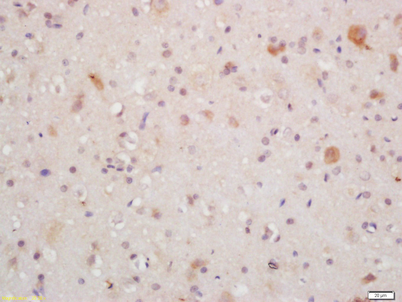 MT-ND5 Rabbit pAb(bs-3952R)-50