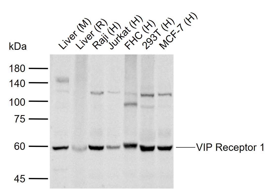 VIP Receptor 1 Rabbit pAb(bs-2