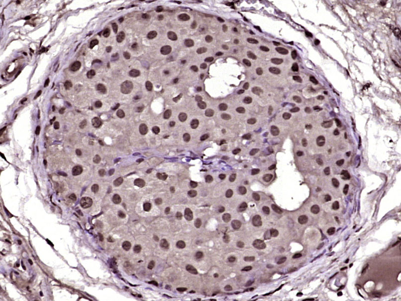 PLK2 Rabbit pAb(bs-12730R)-50u