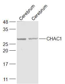 CHAC1 Rabbit pAb(bs-6795R)-50u