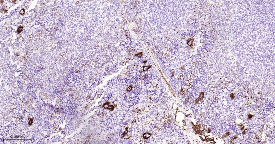 ITGB3 Recombinant Rabbit mAb(b