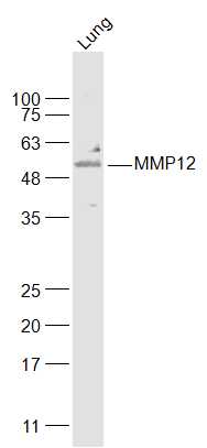 MMP12 Rabbit pAb(bs-23567R)-50