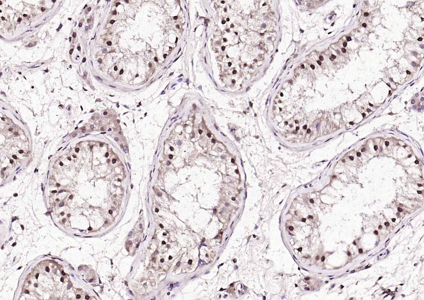 AMPK beta 1/PRKAB1 Rabbit pAb(