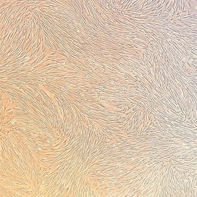 类器官-肿瘤原代癌相关成纤维细胞（CAF）共培养模型