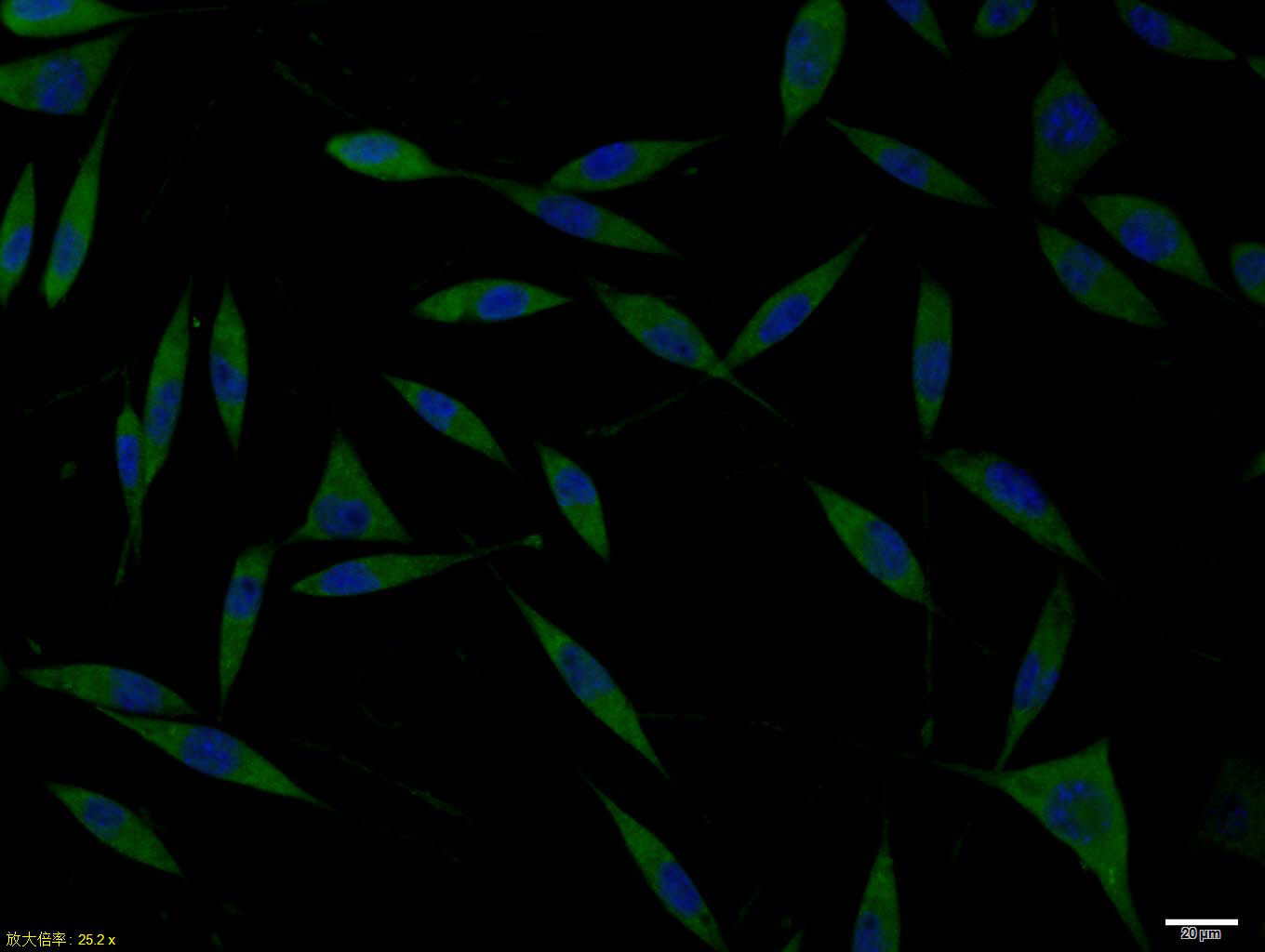 Doublecortin Rabbit pAb(bs-126