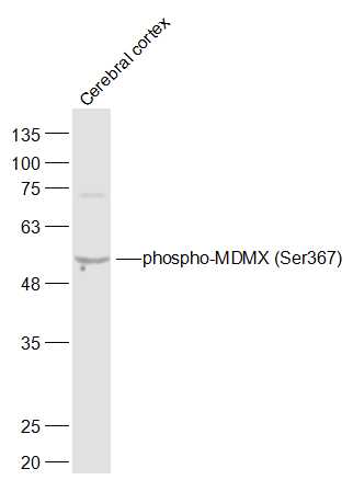phospho-MDMX (Ser367) Rabbit p