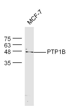 PTPN1 Rabbit pAb(bs-0182R)-50u