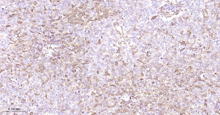 Hsp27 Recombinant Rabbit mAb(b