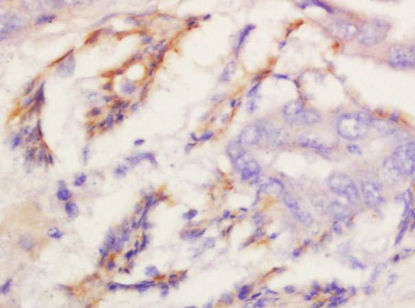 Kv1.8 Rabbit pAb(bs-16866R)-50