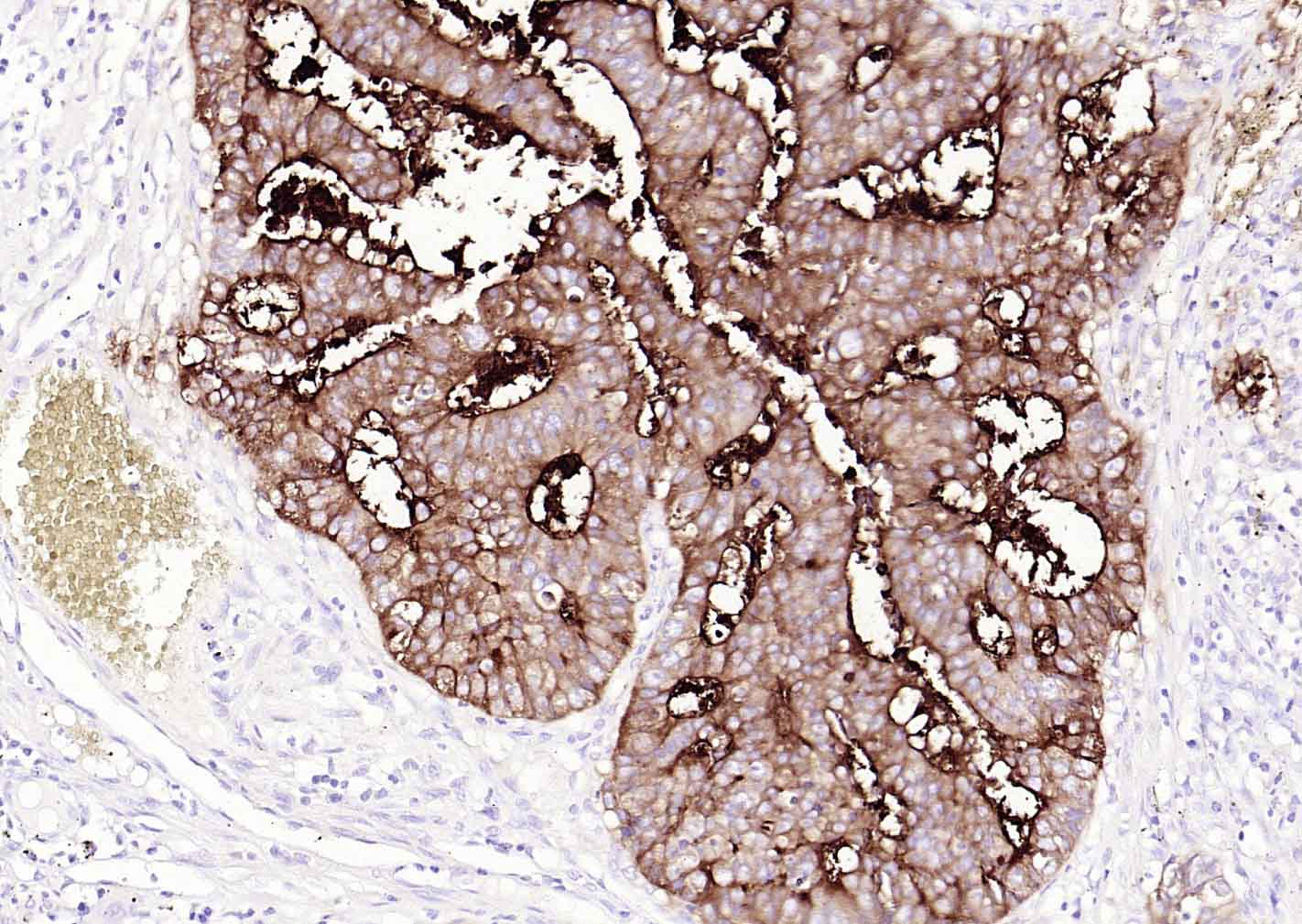 CEACAM5 Mouse mAb(bsm-43141M)-